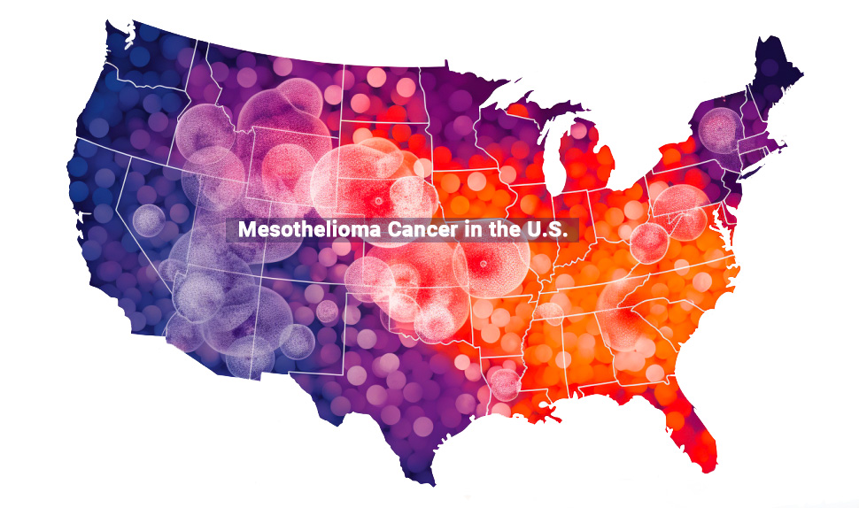 Mesothelioma cancer in the U.S.